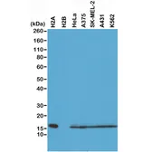 Anti-Histone H2A antibody [RM225] used in Western Blot (WB). GTX33618