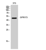 Anti-SREB3 antibody used in Western Blot (WB). GTX33974