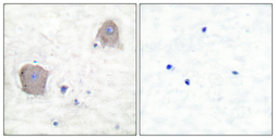 Anti-mGluR4 antibody used in IHC (Paraffin sections) (IHC-P). GTX33978