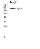 Anti-Cactin antibody used in Western Blot (WB). GTX34146