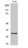 Anti-RPS4Y1 antibody used in Western Blot (WB). GTX34177