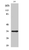 Anti-SH2D5 antibody used in Western Blot (WB). GTX34196