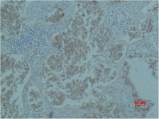 Anti-beta Catenin antibody [4F2] used in IHC (Paraffin sections) (IHC-P). GTX34339
