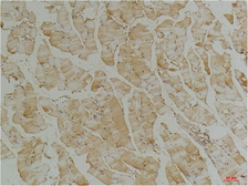 Anti-Desmin antibody [1B12] used in IHC (Paraffin sections) (IHC-P). GTX34350