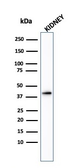 Anti-AMACR antibody used in Western Blot (WB). GTX34409