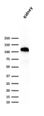 Anti-CDH16 antibody [SPM594] used in Western Blot (WB). GTX34581