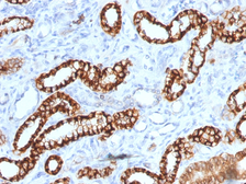 Anti-CDH16 antibody [rCDH16/1071] used in IHC (Paraffin sections) (IHC-P). GTX34582