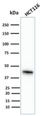 Anti-Cytokeratin 18 antibody [KRT18/836] used in Western Blot (WB). GTX34644