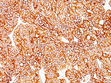 Anti-Cytokeratin 18 antibody [Cocktail] used in IHC (Paraffin sections) (IHC-P). GTX34645
