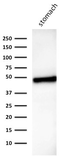 Anti-Cytokeratin 18 antibody [B23.1] used in Western Blot (WB). GTX34646