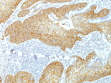 Anti-Desmoglein 3 antibody [DSG3/1535] used in IHC (Paraffin sections) (IHC-P). GTX34677