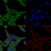 Anti-Fascin 1 antibody [FSCN1/417] used in Immunocytochemistry/ Immunofluorescence (ICC/IF). GTX34718