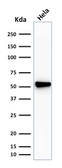 Anti-Fascin 1 antibody [SPM133] used in Western Blot (WB). GTX34719