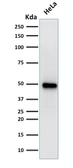 Anti-FOXA1 antibody [FOXA1/1519] used in Western Blot (WB). GTX34740