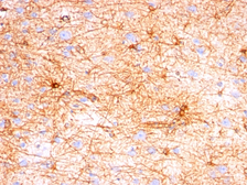 Anti-GFAP antibody [SPM507] used in IHC (Paraffin sections) (IHC-P). GTX34757