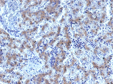 Anti-Glypican-3 antibody [GPC3/1534R] used in IHC (Paraffin sections) (IHC-P). GTX34765