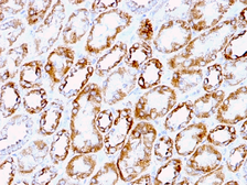 Anti-Laminin gamma 1 antibody [A5] used in IHC (Paraffin sections) (IHC-P). GTX34805