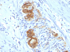Anti-NCAM antibody [123C3.D5] used in IHC (Paraffin sections) (IHC-P). GTX34890