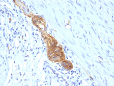 Anti-NCAM antibody [SPM489] used in IHC (Paraffin sections) (IHC-P). GTX34892