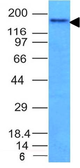 Anti-NCAM antibody [NCAM1/795] used in Western Blot (WB). GTX34894