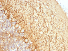 Anti-NF-L antibody [NR-4] used in IHC (Paraffin sections) (IHC-P). GTX34902