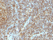 Anti-PCNA antibody [SPM350] used in IHC (Paraffin sections) (IHC-P). GTX34963