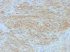 Anti-TMEM16A antibody [SPM580] used in IHC (Paraffin sections) (IHC-P). GTX35126