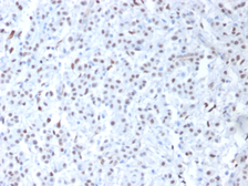 Anti-Wilms Tumor 1 antibody [6F-H2] used in IHC (Paraffin sections) (IHC-P). GTX35172