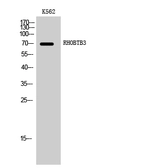 Anti-RHOBTB3 antibody used in Western Blot (WB). GTX35183