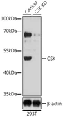 Anti-CSK antibody used in Western Blot (WB). GTX35201