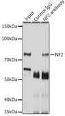 Anti-Merlin antibody used in Immunoprecipitation (IP). GTX35202