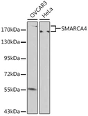Anti-BRG1 antibody used in Western Blot (WB). GTX35204