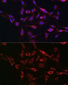 Anti-RAB5A antibody used in Immunocytochemistry/ Immunofluorescence (ICC/IF). GTX35207