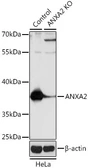 Anti-Annexin II antibody used in Western Blot (WB). GTX35208