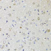 Anti-beta 2 Microglobulin antibody used in IHC (Paraffin sections) (IHC-P). GTX35209