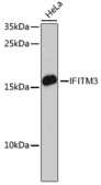 Anti-IFITM3 antibody used in Western Blot (WB). GTX35214