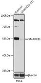 Anti-BAF57 antibody used in Western Blot (WB). GTX35217