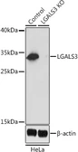Anti-Galectin 3 antibody used in Western Blot (WB). GTX35218
