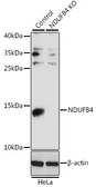 Anti-NDUFB4 antibody used in Western Blot (WB). GTX35219