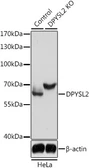 Anti-CRMP2 antibody used in Western Blot (WB). GTX35221