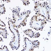 Anti-PDCD4 antibody used in IHC (Paraffin sections) (IHC-P). GTX35232