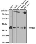 Anti-PP1C gamma antibody used in Western Blot (WB). GTX35235