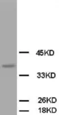 Anti-OPCML antibody used in Western Blot (WB). GTX38534