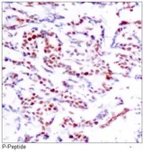 Anti-ATF2 (phospho Ser112) antibody used in IHC (Paraffin sections) (IHC-P). GTX38683