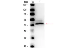 Anti-Hexokinase antibody (HRP) used in Western Blot (WB). GTX40547