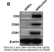 Anti-CD81 antibody [Eat2] used in Western Blot (WB). GTX41794