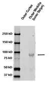 Anti-ENaC Beta antibody used in Western Blot (WB). GTX41971
