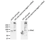 Anti-ENaC Gamma antibody used in Western Blot (WB). GTX41972