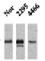 Anti-CaMKII alpha antibody [22B1] used in Western Blot (WB). GTX41977