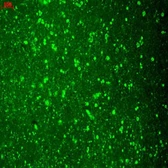 Anti-Cav1.2 antibody [S57-46] used in Immunohistochemistry (IHC). GTX41981